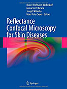 Reflectance Confocal Microscopy for Skin Diseases